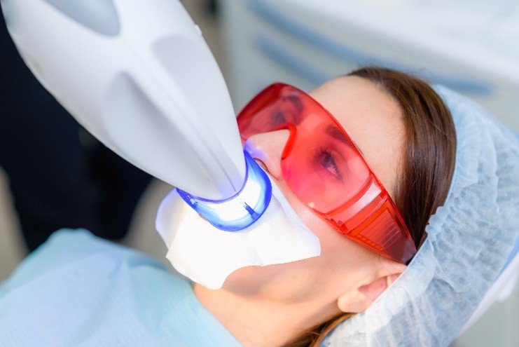 Bleaching Zürich Eine Frau trägt eine Schutzbrille und lässt sich ihre Zähne mit einer UV-Lampe bleichen.
