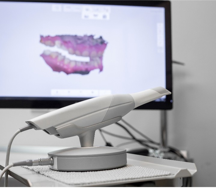 Brücken Vorbereitung Im Vordergrund steht ein dentaler 3D-Scanner und im Hintergrund sieht man den digitalen Scan auf einem Bildschirm.