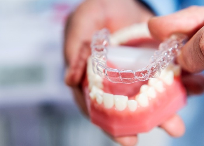 Invisalign Eine transparente Invisalign wird zu Anschauungszwecken an ein künstliches Gebiss gehalten.