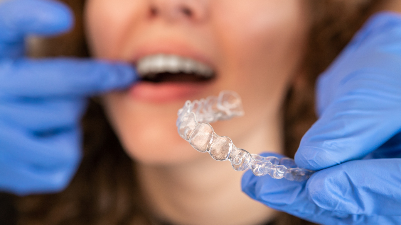 Schnarchschiene Der Zahnarzt hält eine transparente Schiene vor die Patientin.